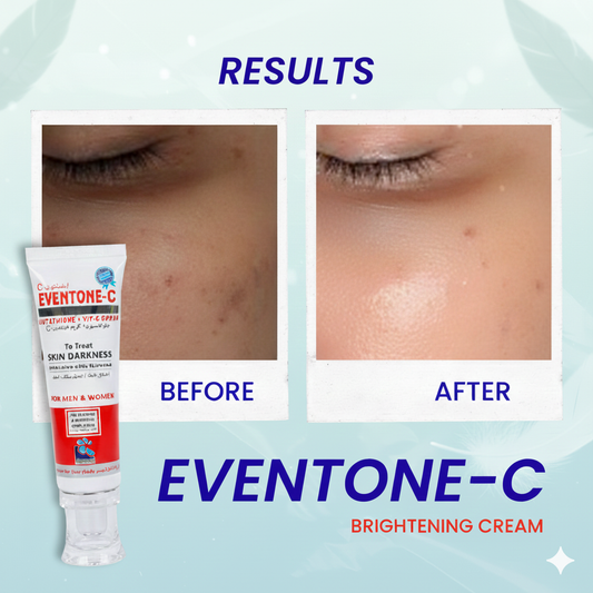 Eventone-C Cream - Skin Whitening & Brightening Formula (Both for Men & Women)