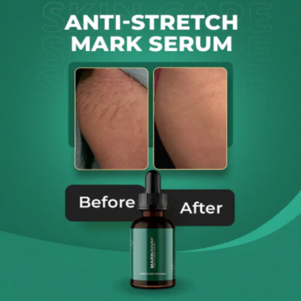 Anti-stretch mark serum with 'Before' and 'After' comparison on a green background