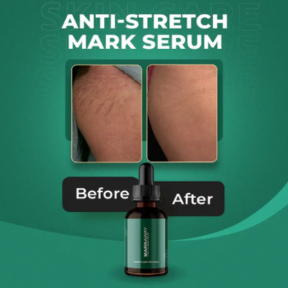 Anti-stretch mark serum with 'Before' and 'After' comparison on a green background