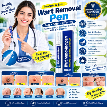 Wart Remover Pen – Easy Wart Removal Treatment for Hands, Feet & Skin
