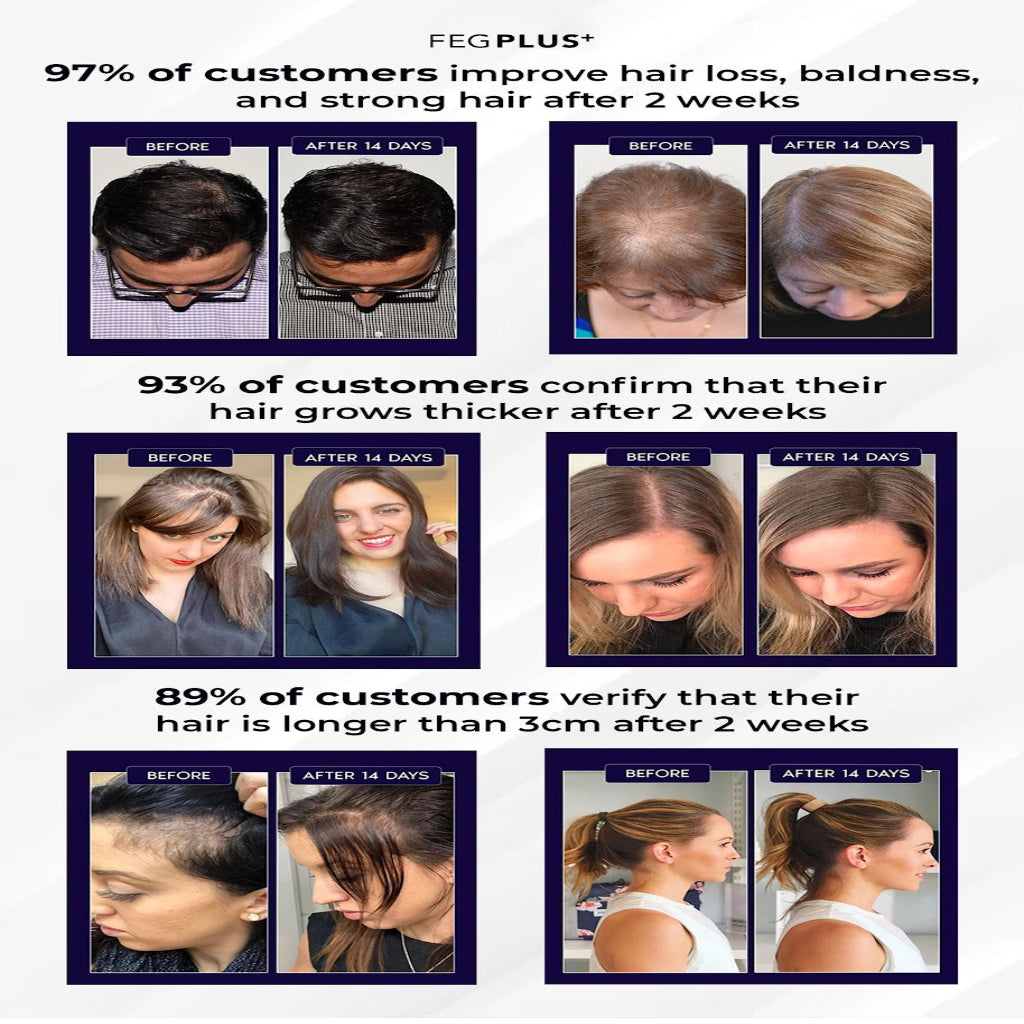 FEG Plus Hair Growth Support Serum Before and After Results Image