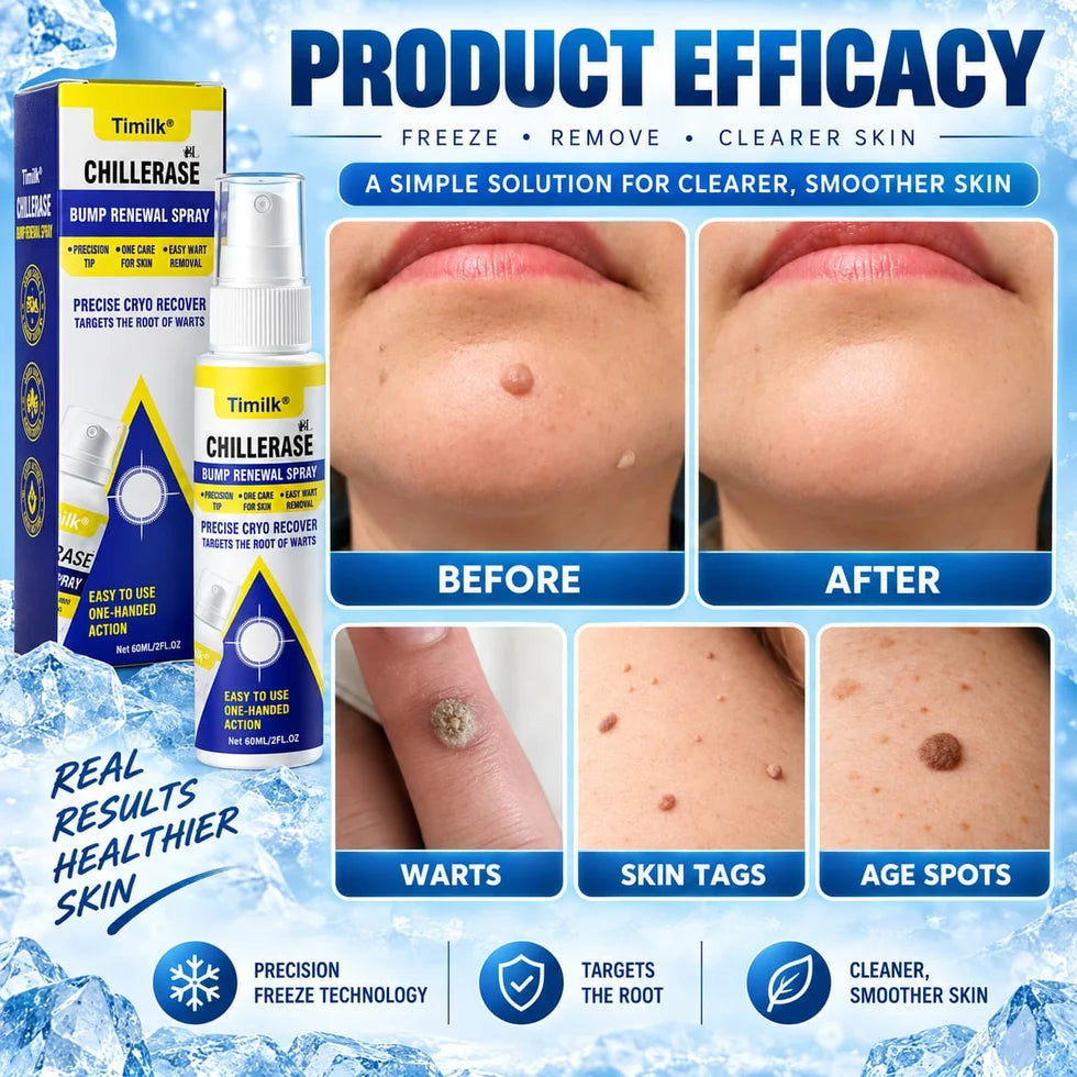 Timilk Wart & Mole Removal Spray
